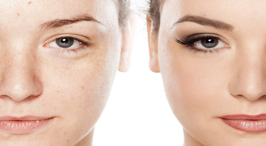 Microblading – For perfect eyebrows